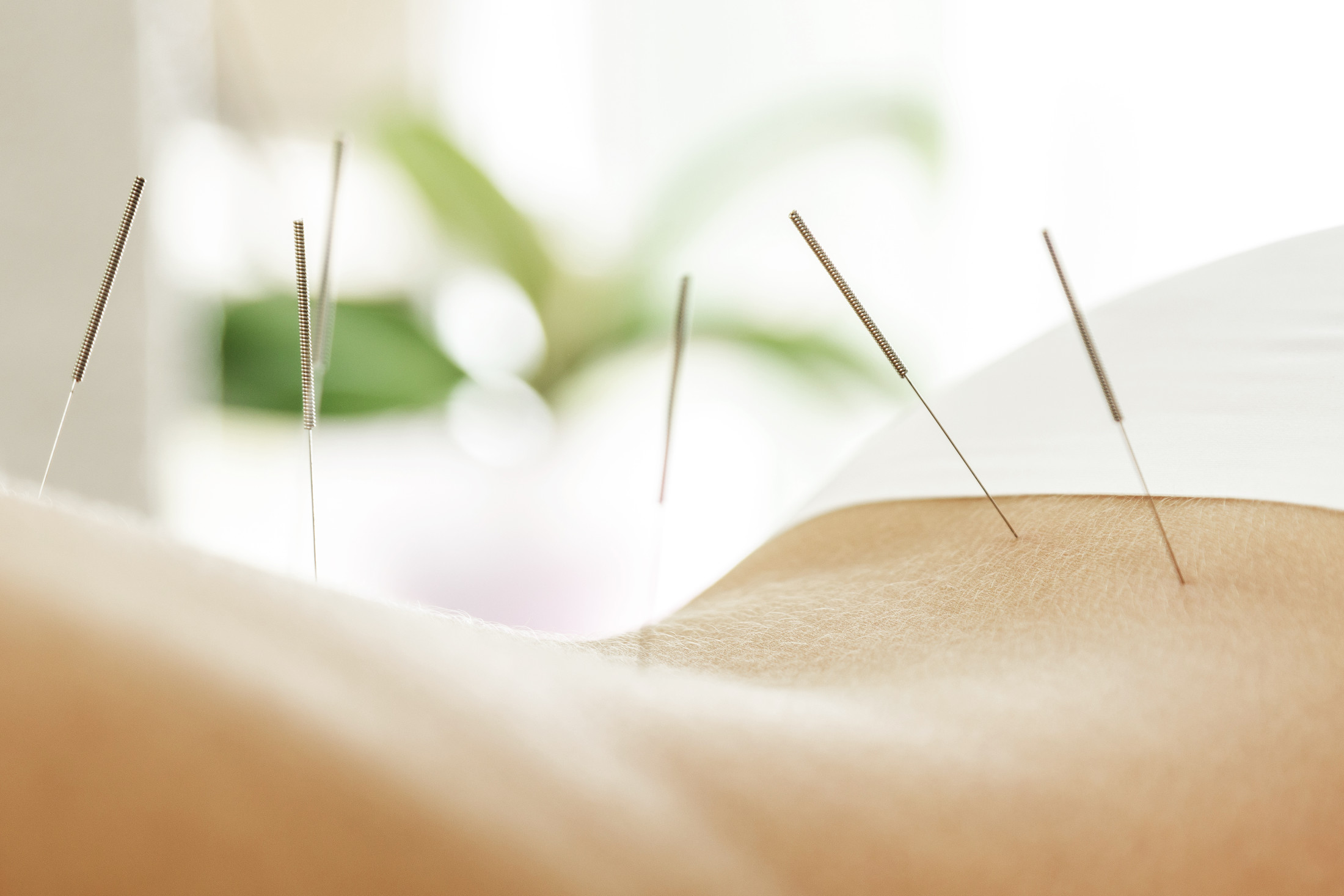 Akupunktur Ganzheitliche Frauenheilkunde